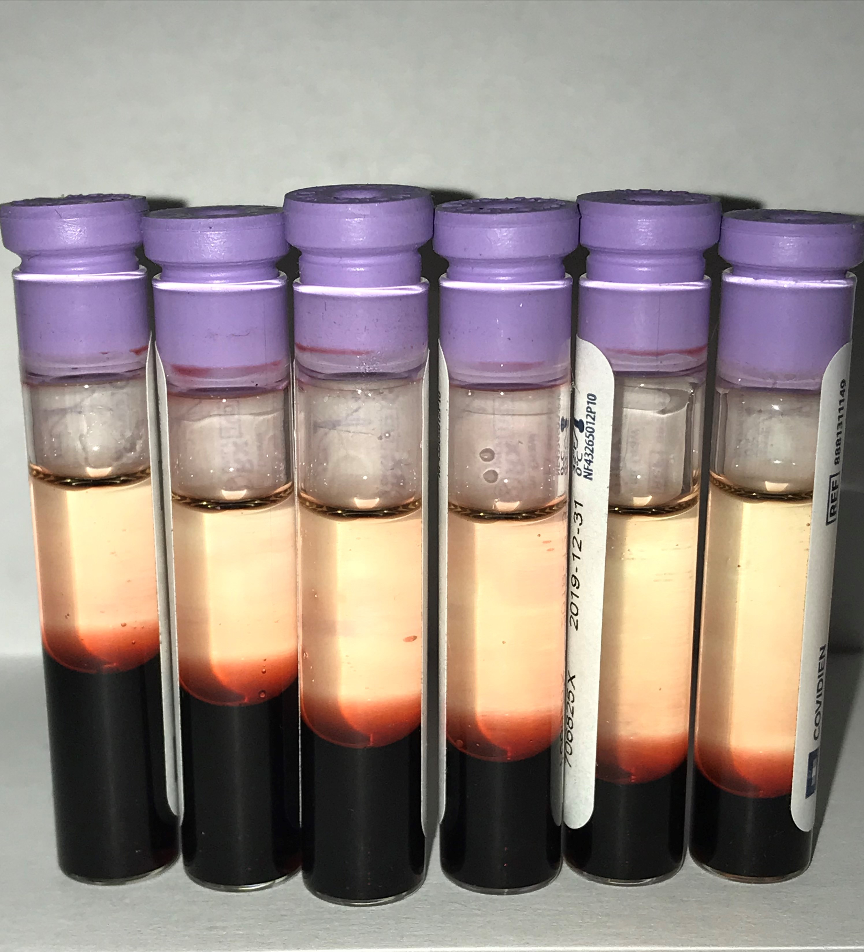 A group of five test tubes filled with liquids of various colors, arranged in a row on a laboratory bench.